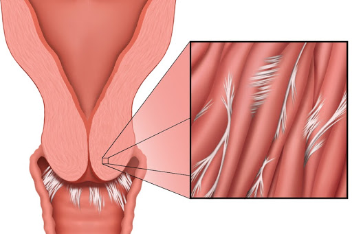 aseel kalbouneh add Cervix Penetration Stories photo