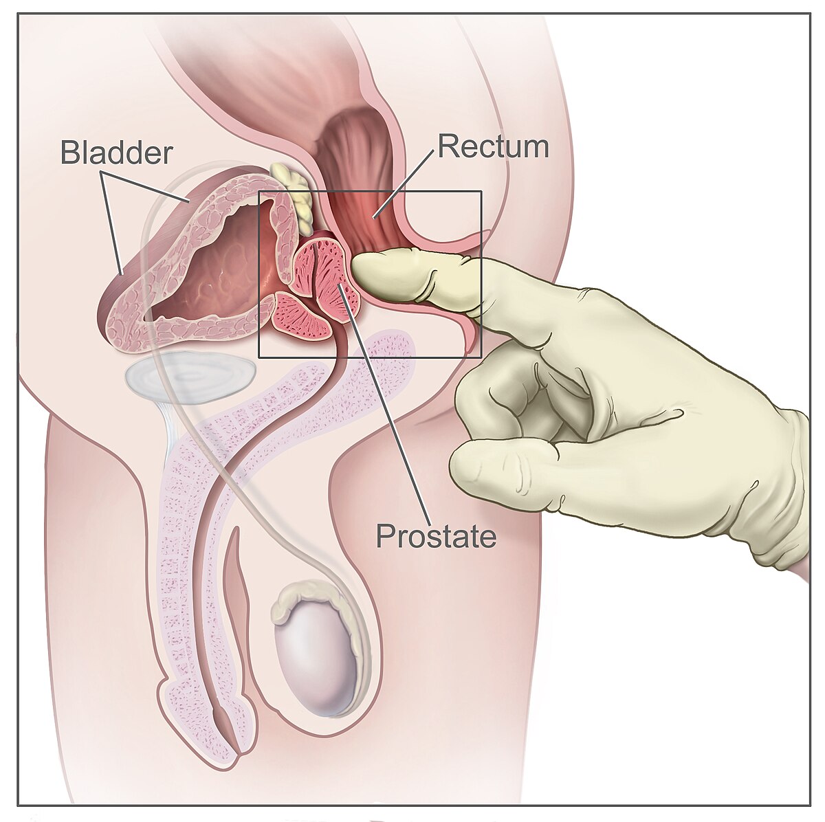 barjesh nanda add Cum During Prostate Exam photo