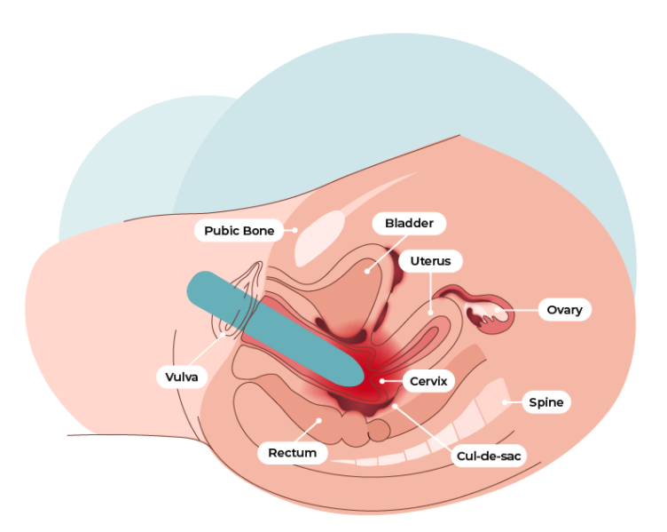 doug fung add Cervix Penetration Stories photo