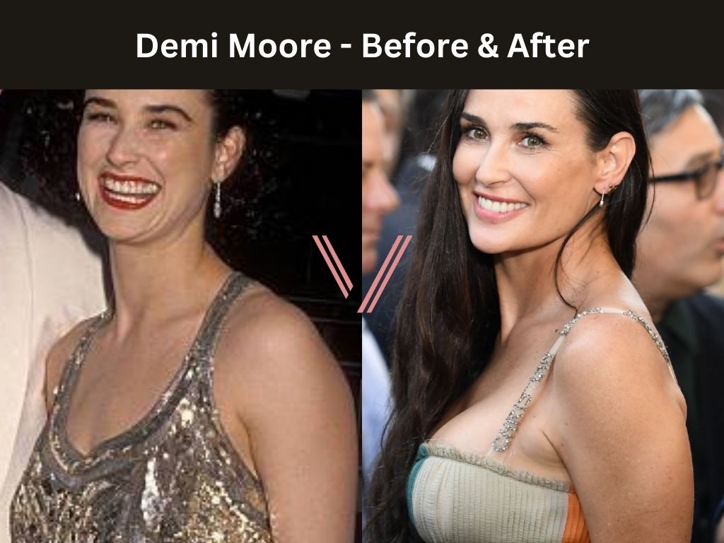 chris walick add Demi Moores Tits photo