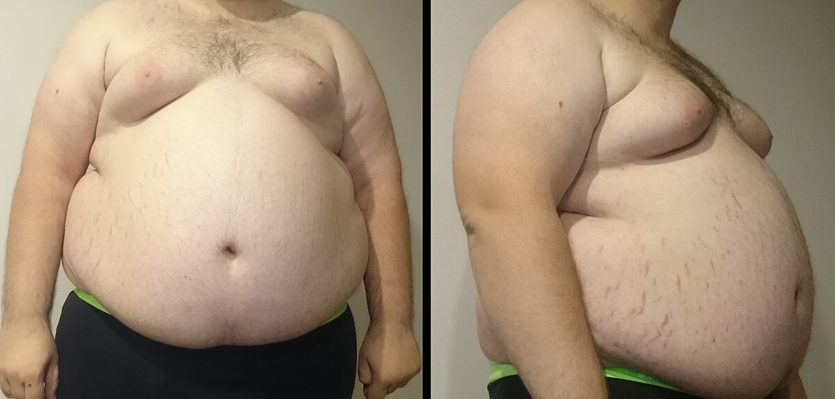 beth balogh add Obese Men Nude photo