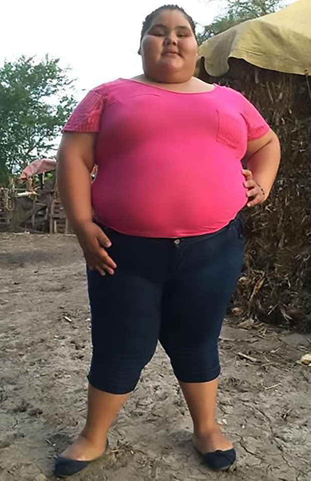 cheryl anne collins add Fat Teens Nude photo