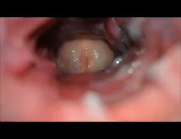 aaron privitera add Porn Ultrasound photo