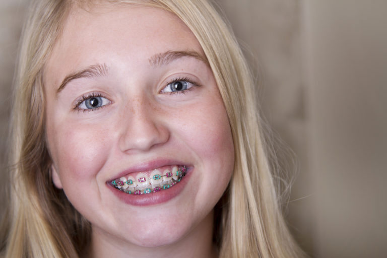 adem akin add How To Suck Dick With Braces photo