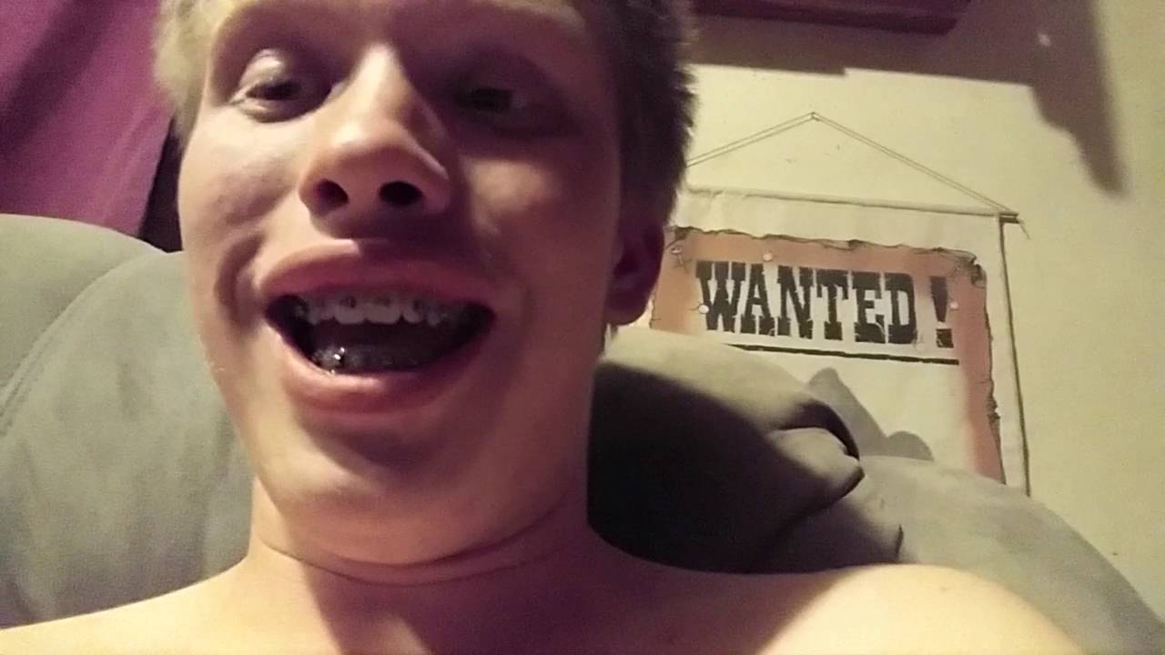 connie servative add How To Suck Dick With Braces photo