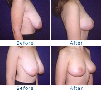 bruce renshaw add Long Hanging Titties photo