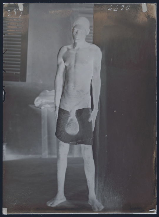 alex hottel add Naked Scrotum photo