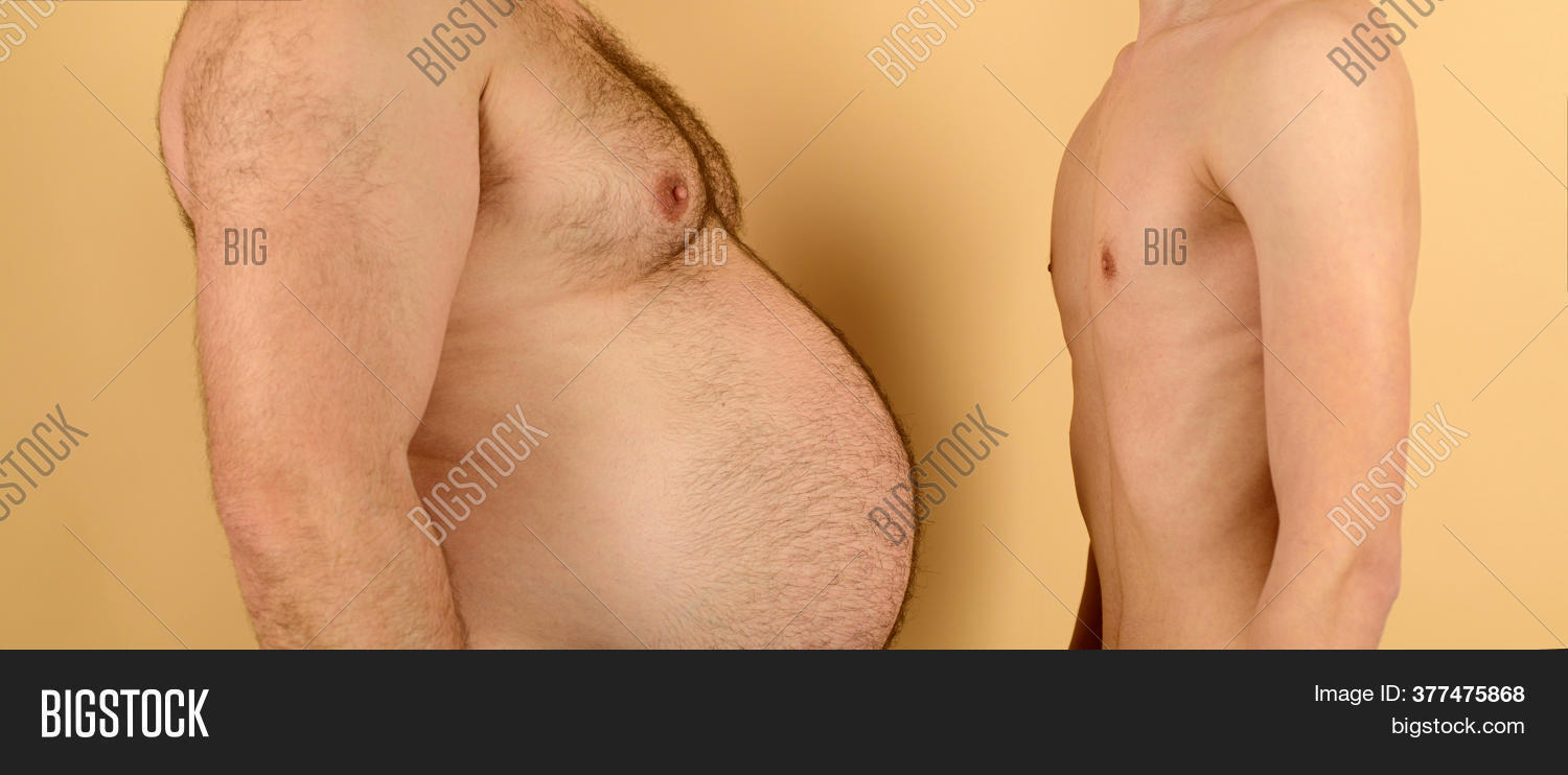 amy steelman add Obese Men Nude photo