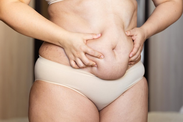 catherine hennessy add Overweight Naked Women photo