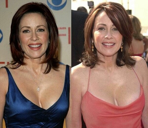 anthony mwendwa add Patricia Heaton Titties photo