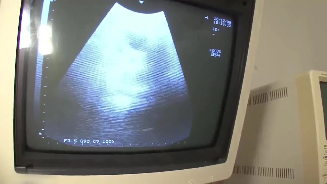 brad coleman add Porn Ultrasound photo