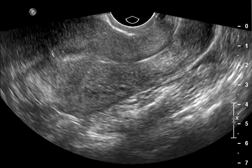 danny strickler add Porn Ultrasound photo