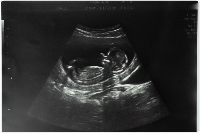 Porn Ultrasound 15464