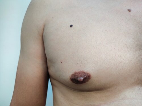 alessandro ferrante add Puffy Big Tits photo