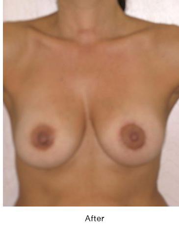 doug peach add Tear Drop Boobs Nude photo
