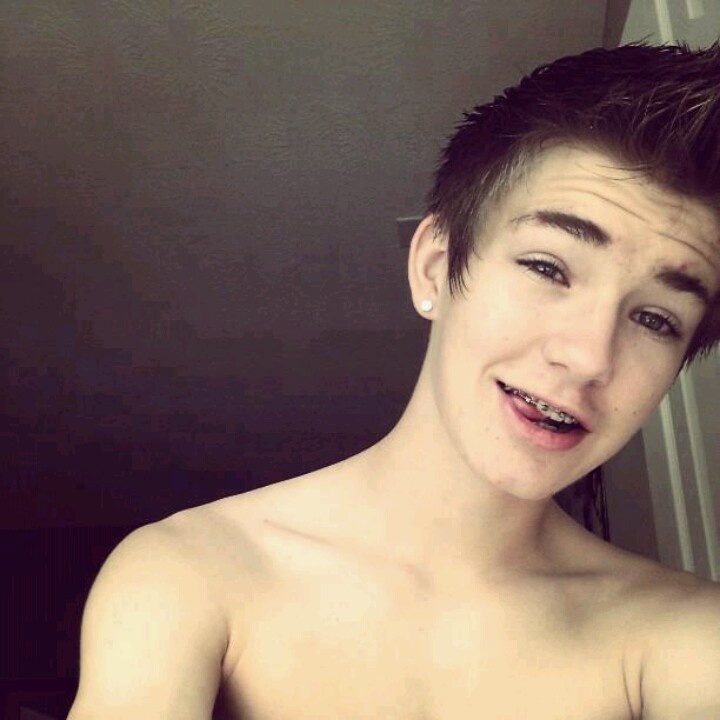 bong alim add Twinks With Braces photo