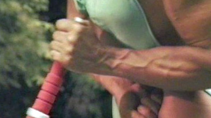 dana harrsch add Vein Fetish photo
